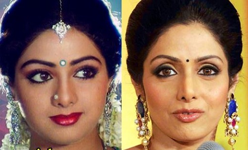 Sridevi plastic surgery