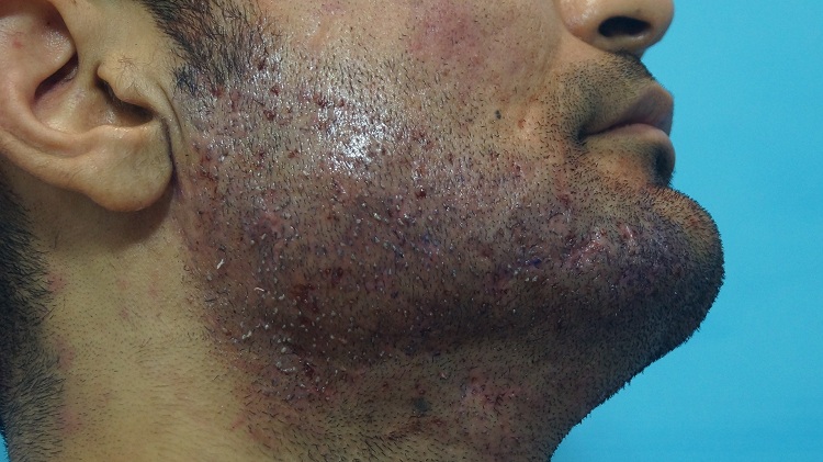 case study imm post op pic 2