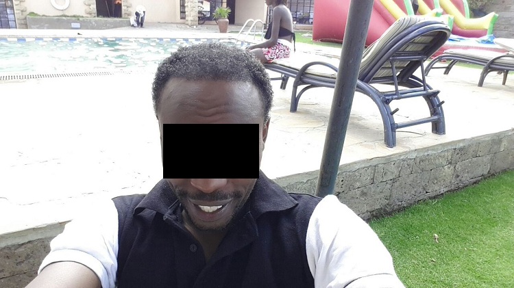 Curly Hair Patient Result 2