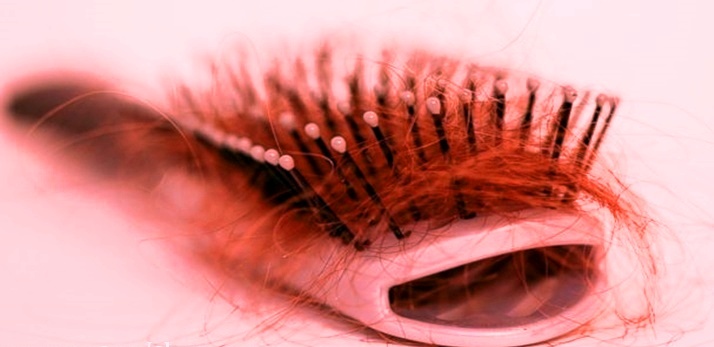 when hair loss is too much hair loss