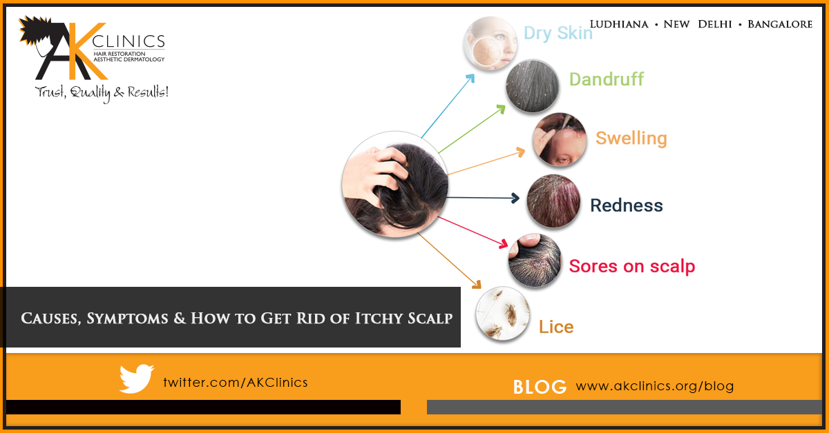 Symptoms of itchy scalp