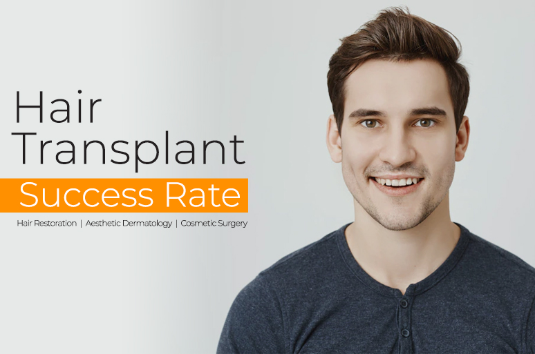 Hair Transplant Success Hair Transplant Success Rate in India